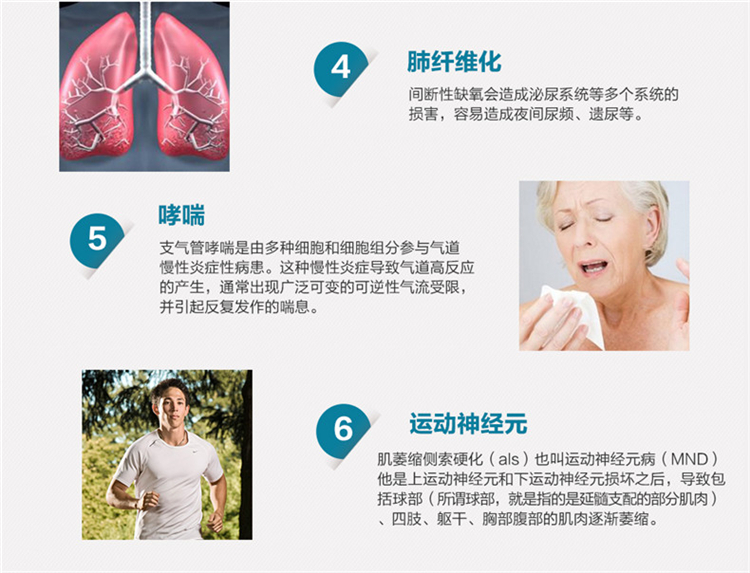 昆明瑞迈特呼吸机，瑞迈特双水平呼吸机，瑞迈特呼吸机，瑞迈特呼吸机代理