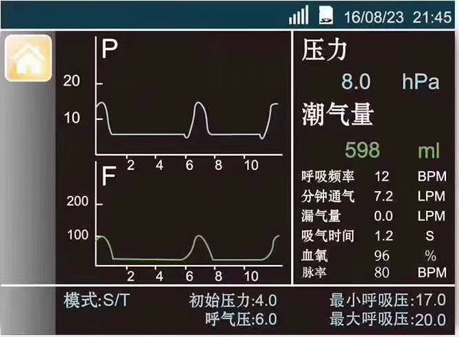 昆明呼吸机 昆明制氧机